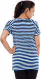 Fabtag Casual Short Sleeve Striped Women's Top